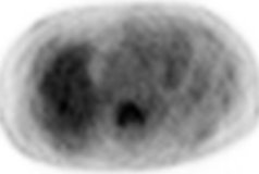 fig2_th