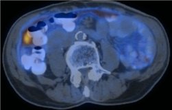 Department of Diagnostic Radiology